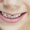 Teeth Whitening Sarnia