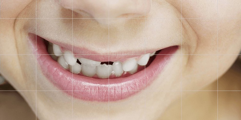 Teeth Whitening Sarnia