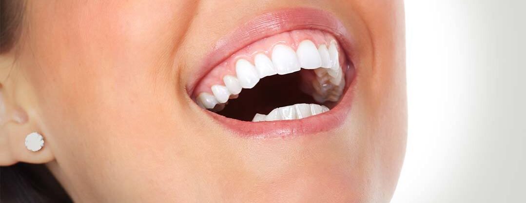 A woman opens her mouth and shows her teeth