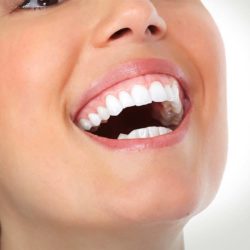 A woman opens her mouth and shows her teeth