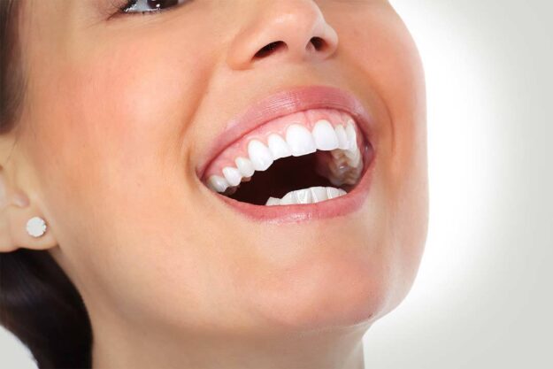 A woman opens her mouth and shows her teeth