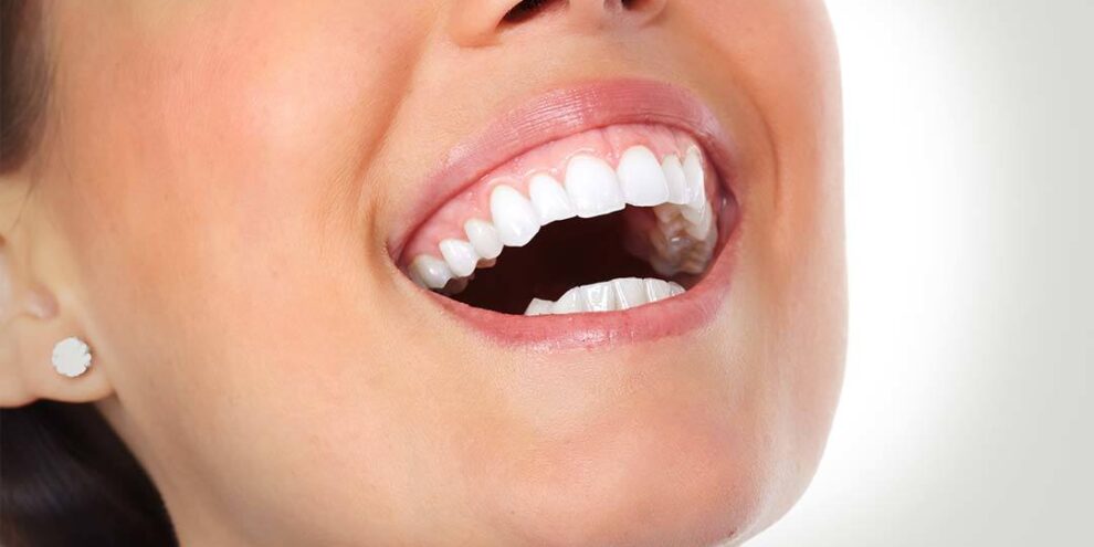 A woman opens her mouth and shows her teeth