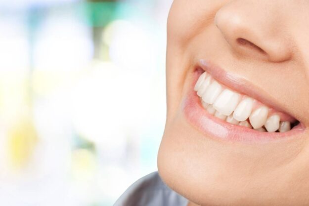 teeth whitening sarnia