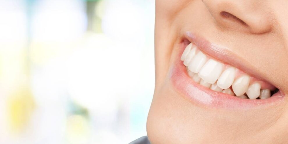 teeth whitening sarnia