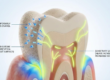 family dental sarnia
